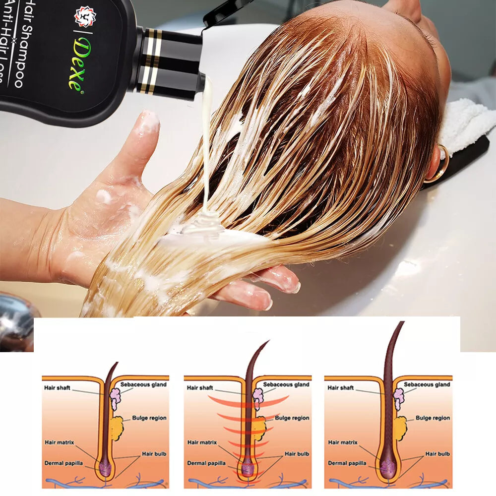 Dexe Anti Hair Loss Hair Shampoo For Men & Women 200ml